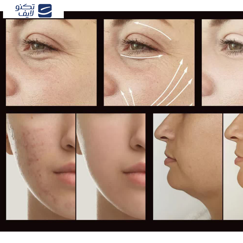 دستگاه جوانسازی هایفرکوئنسی مدل  LZ-006A