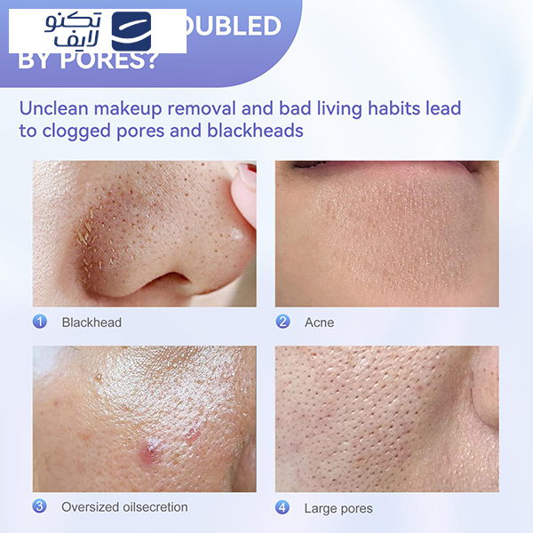 اتو صورت آنلن مدل B0CB3BS99L